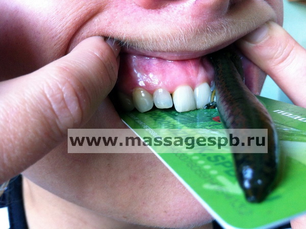 http://massagespb.ru/images/hirudoterapija3_sm.jpg